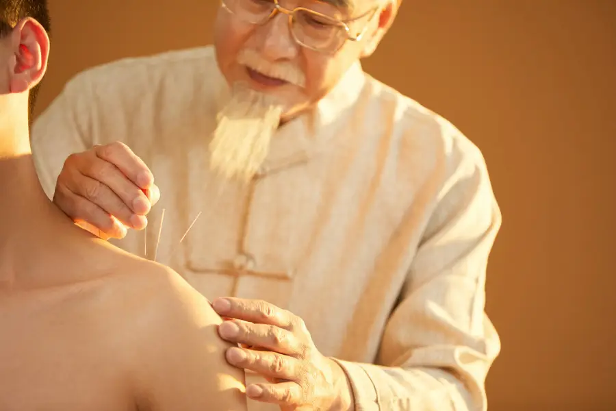 Chinese practitioner practicing acupuncture